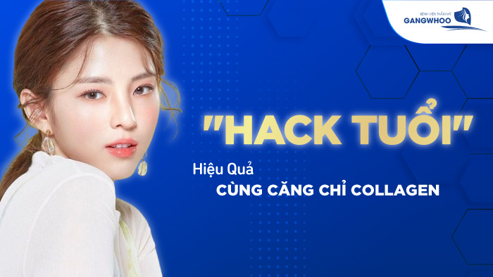 Căng da mặt bằng chỉ collagen