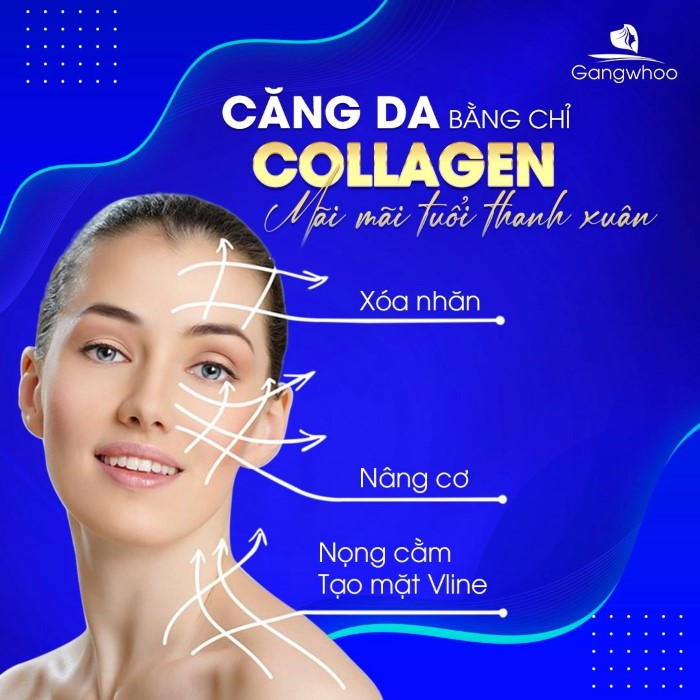 Hiệu quả căng da mặt bằng chỉ collagen