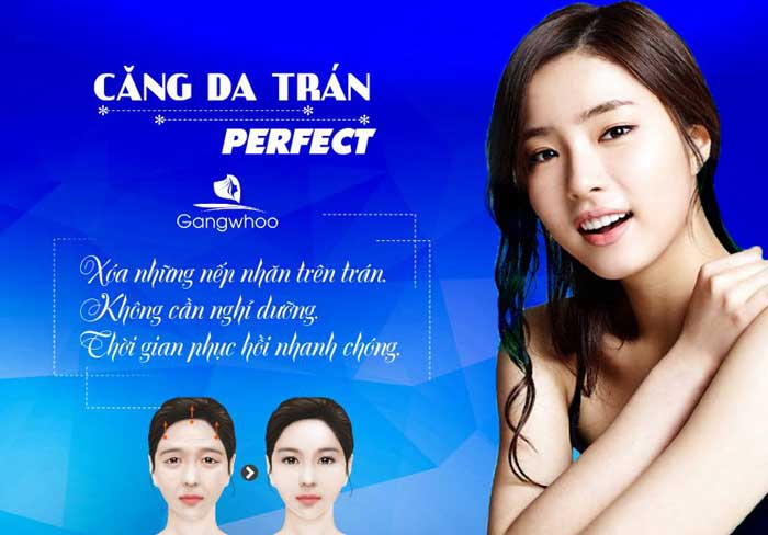 Căng da trán perfect