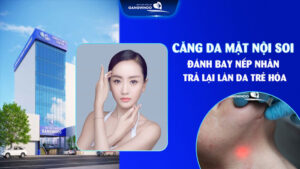 Căng da mặt nội soi