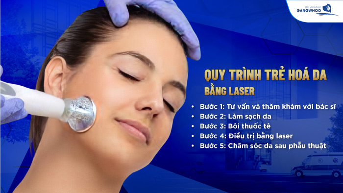 Căng da mặt bằng laser