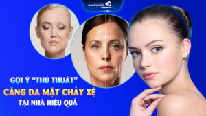 Căng da mặt chảy xệ