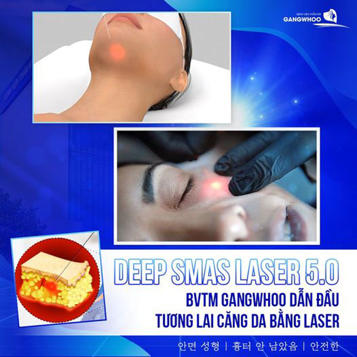 Căng Da Mặt Deep Smas Laser 5.0