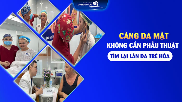 Căng da mặt không cần phẫu thuật