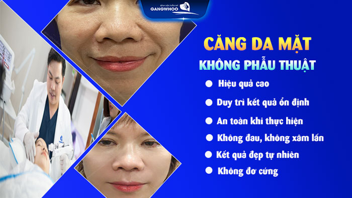 Căng da mặt không cần phẫu thuật