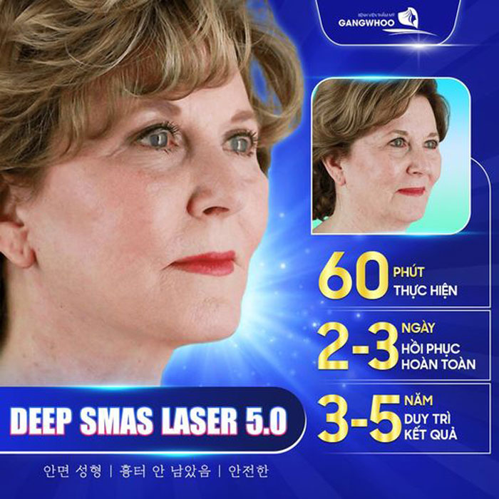 Căng Da Mặt Deep Smas Laser 5.0