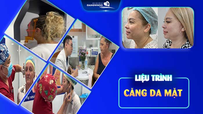 Liệu trình căng da mặt