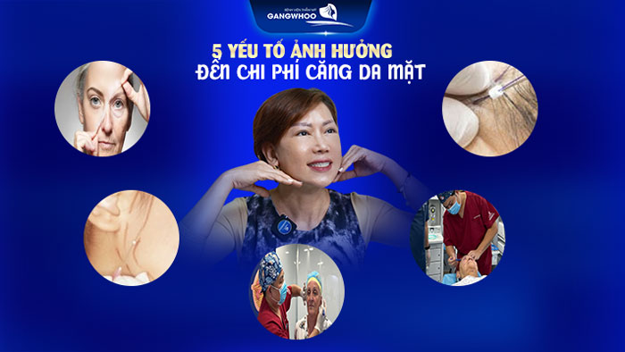 Căng da mặt giá bao nhiêu