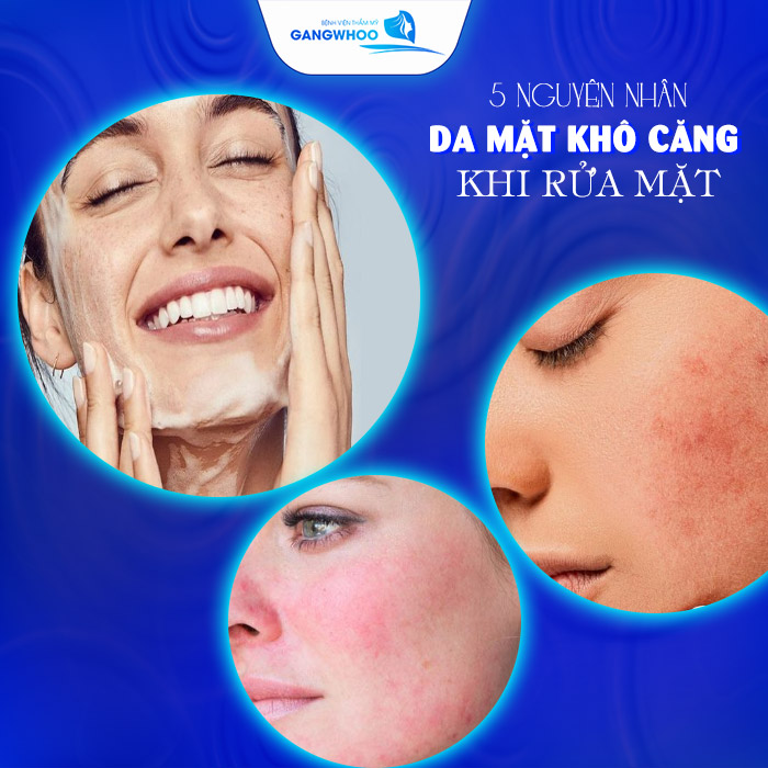 Da Khô Căng Sau Khi Rửa Mặt