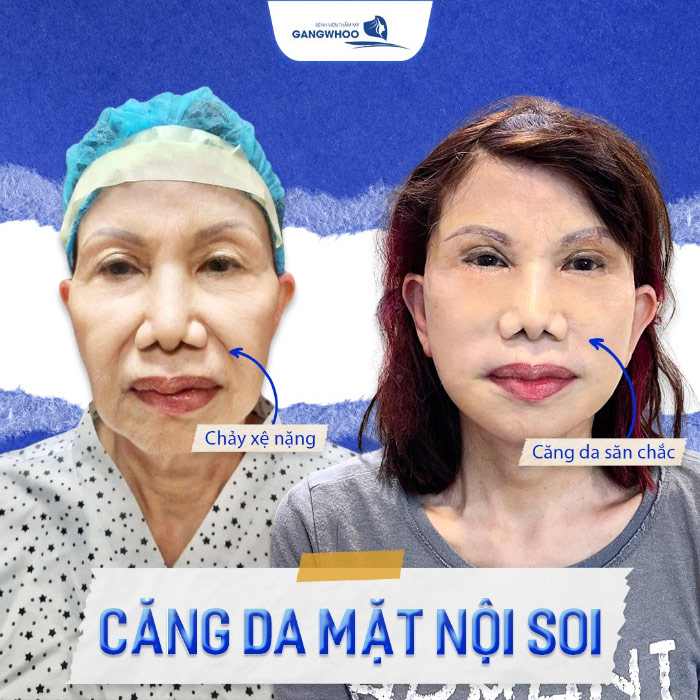 Không Hối Hận! Nếu Bạn Căng Da Mặt Ở Quảng Bình Với 7 Cơ Sở Sau 