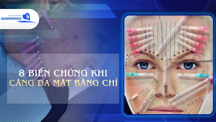 Biến Chứng Khi Căng Da Mặt Bằng Chỉ