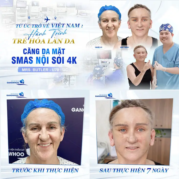 An tâm Làm Đẹp Với Top 6 Địa Chỉ Căng Da Mặt Ở Thái Bình Uy Tín