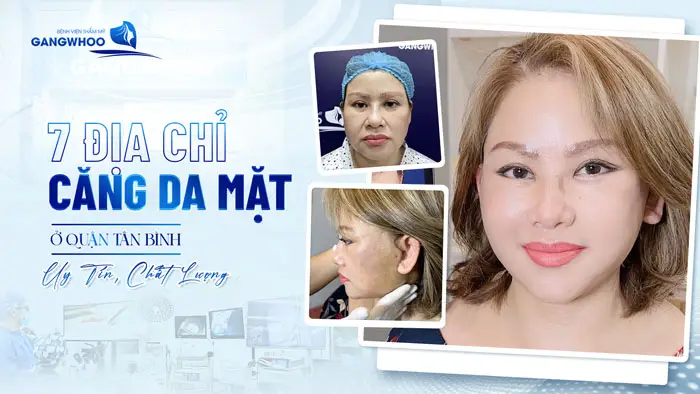 7 Địa Chỉ Căng Da Mặt Ở Quận Tân Bình Uy Tín, Chất Lượng