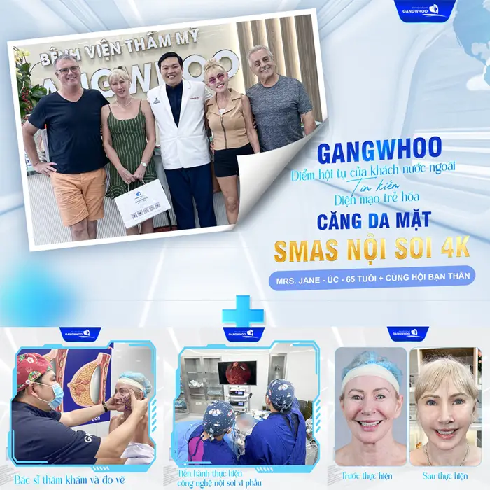 Bật Mí 6 Địa Chỉ Căng Da Mặt Ở Quận 5 TPHCM Chất Lượng Cao