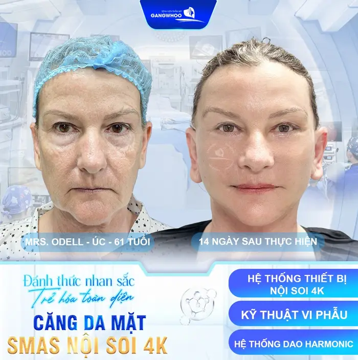 Tìm Địa Chỉ Căng Da Mặt Ở Bình Thuận? Xem Ngay Gợi Ý Này!