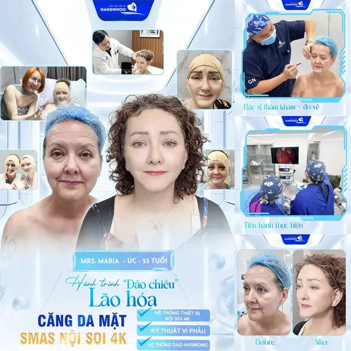 Top 10 Địa Chỉ Căng Da Mặt Ở Cần Thơ Giúp Bạn Trẻ Hơn Tuổi Thật