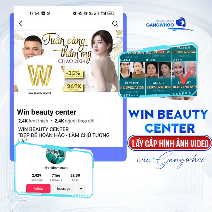 Win Beauty Center Lấy Cắp Hình Ảnh Video Của Gangwhoo Lừa Đảo Khách Hàng
