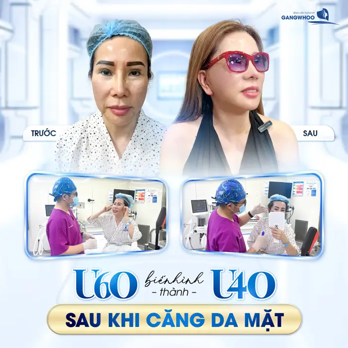 Muốn Lão Hóa Ngược Đến Ngay 5 Cơ SỞ Căng Da Mặt Ở Vĩnh Phúc Này