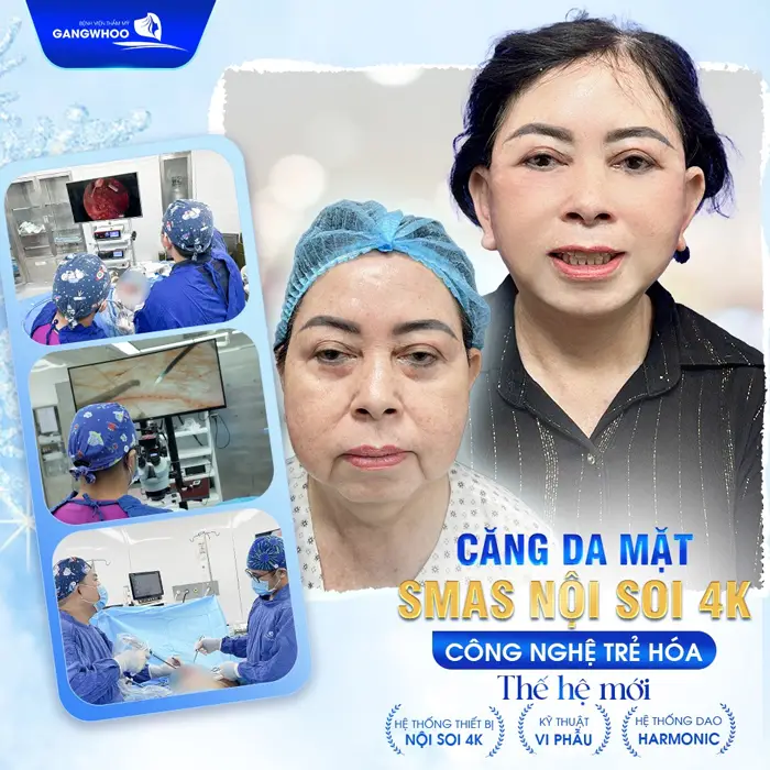 4 Địa Chỉ Căng Da Mặt Ở Bình Định Giúp Bạn Trẻ Hơn Tuổi Thật