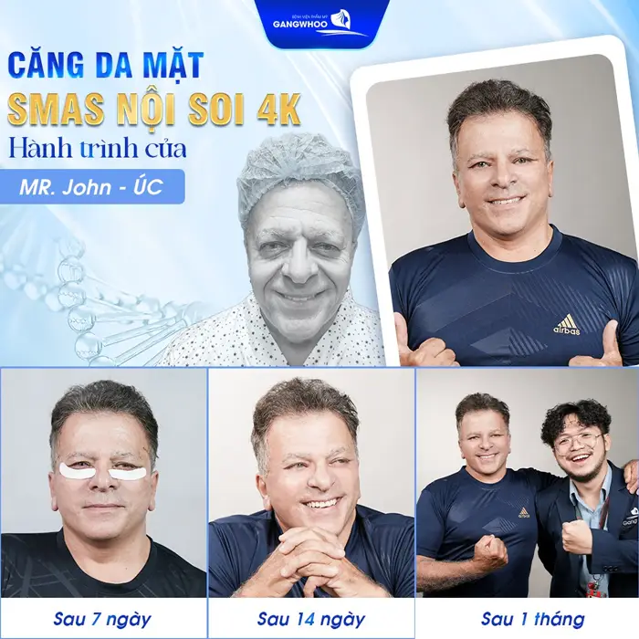 Khám Phá Ngay 5 Địa Chỉ Căng Da Mặt Ở Quảng Ninh Đẹp Và An Toàn