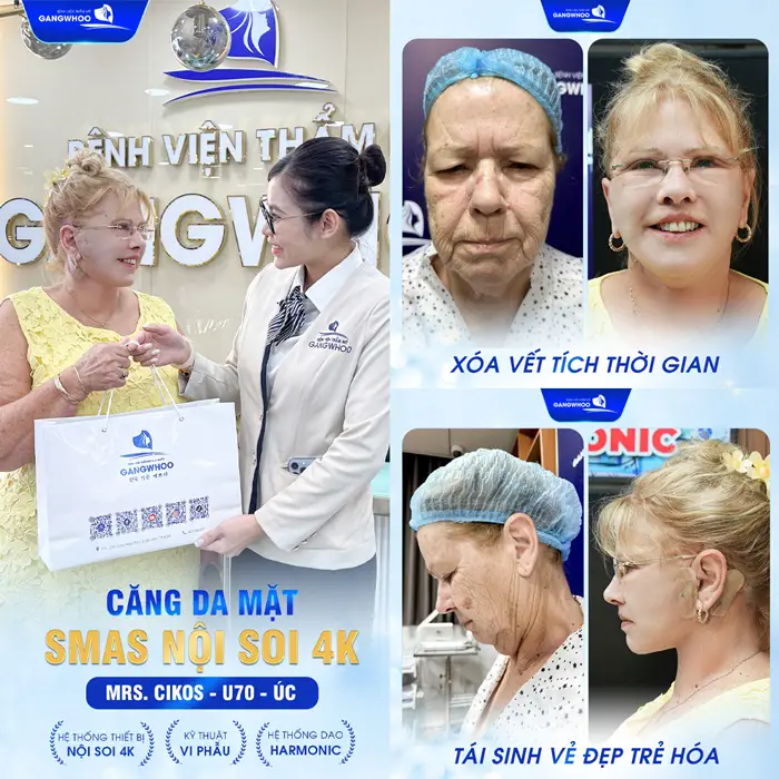 Gợi Ý 5 Địa Chỉ Căng Da Mặt Ở Nghệ An Uy Tín - Hiệu Quả 