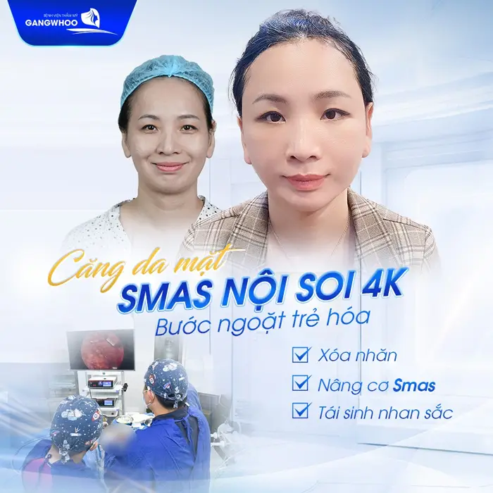 5 Địa Chỉ Căng Da Mặt Ở Bắc Ninh Uy Tín Cho Làn Da Trẻ Hóa