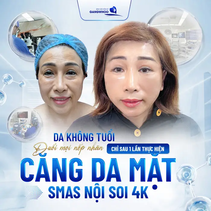 5+ Địa Chỉ Căng Da Mặt Ở Khánh Hòa Uy Tín Đẹp Bền Lâu