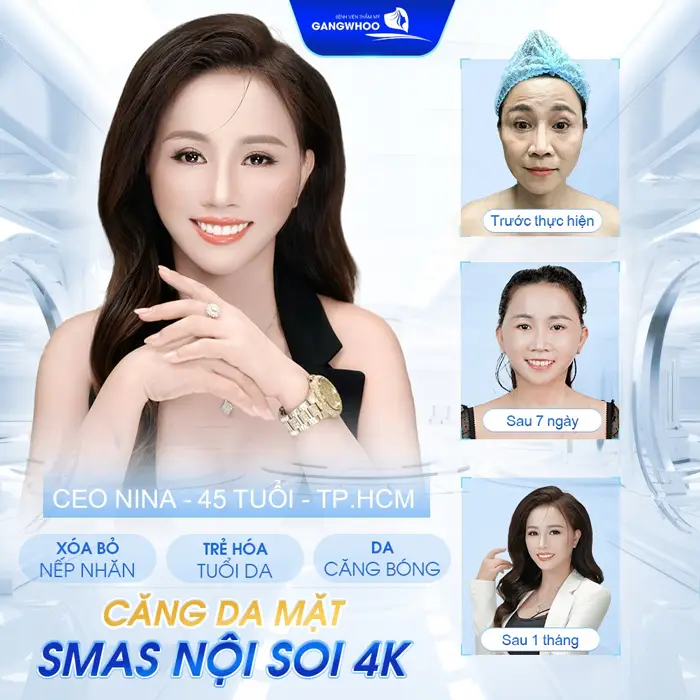 4 Địa Chỉ Căng Da Mặt Ở Bắc Giang Lý Tưởng Cho Làn Da Trẻ Hóa