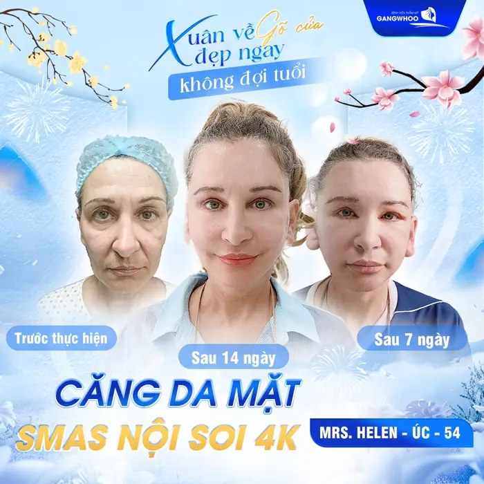 Gợi Ý 5 Địa Chỉ Căng Da Mặt Ở Nghệ An Uy Tín - Hiệu Quả 