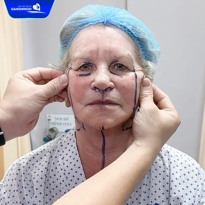 Tìm Hiểu Ngay 10 Địa Chỉ Căng Da Mặt Ở TPHCM Giúp Bạn Trẻ Hơn Tuổi Thật