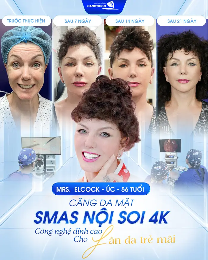 Tại Sao Nên Căng Da Mặt Ở Tây Ninh Tại 4 Cơ Sở Này Ngay Hôm Nay!