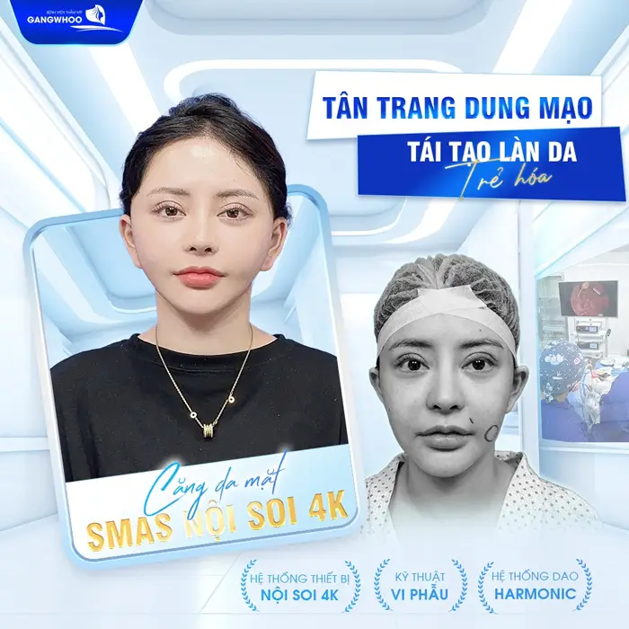 Hé Lộ 5 Nơi Căng Da Mặt Ở Ninh Bình Uy Tín Giúp Bạn “Hồi Xuân” 