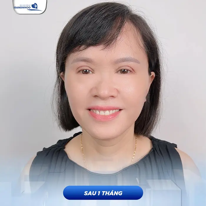 Muốn Lão Hóa Ngược Đến Ngay 5 Cơ SỞ Căng Da Mặt Ở Vĩnh Phúc Này