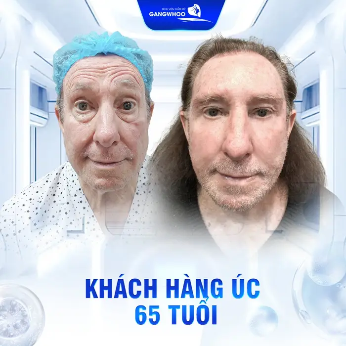 Review 7 Địa Chỉ Căng Da Mặt Ở Đồng Nai Đẹp Và An Toàn, Đừng Bỏ Lỡ!