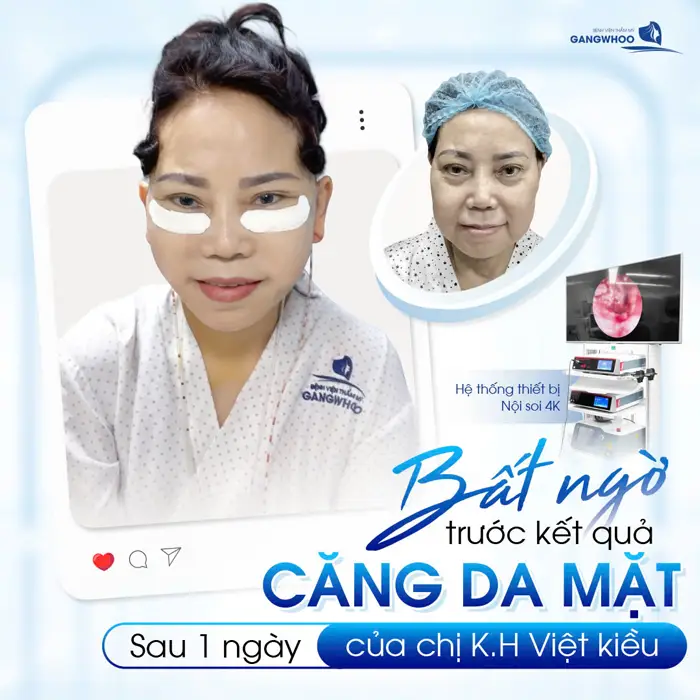 Review 7 Địa Chỉ Căng Da Mặt Ở Đồng Nai Đẹp Và An Toàn, Đừng Bỏ Lỡ!