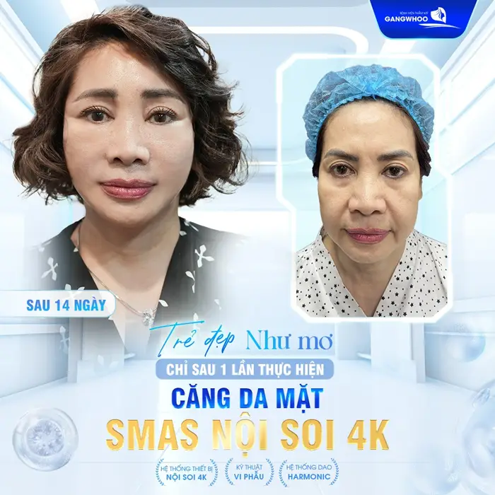 4 Nơi Căng Da Mặt Ở Trà Vinh Uy Tín "Đánh Bại" Làn Da Chảy Xệ