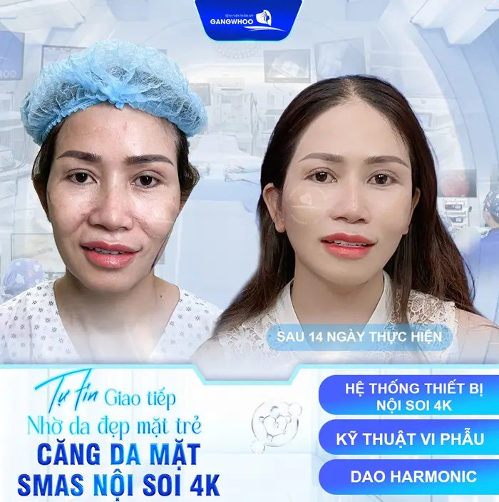 Trẻ Hơn Khi Biết Đến 4 Cơ Sở Căng Da Mặt Ở Sóc Trăng Này