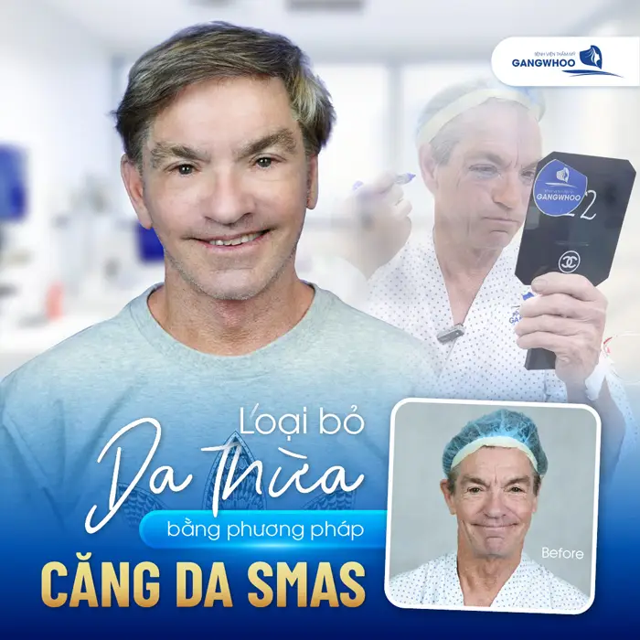 Top 10 Địa Chỉ Căng Da Mặt Ở Cần Thơ Giúp Bạn Trẻ Hơn Tuổi Thật