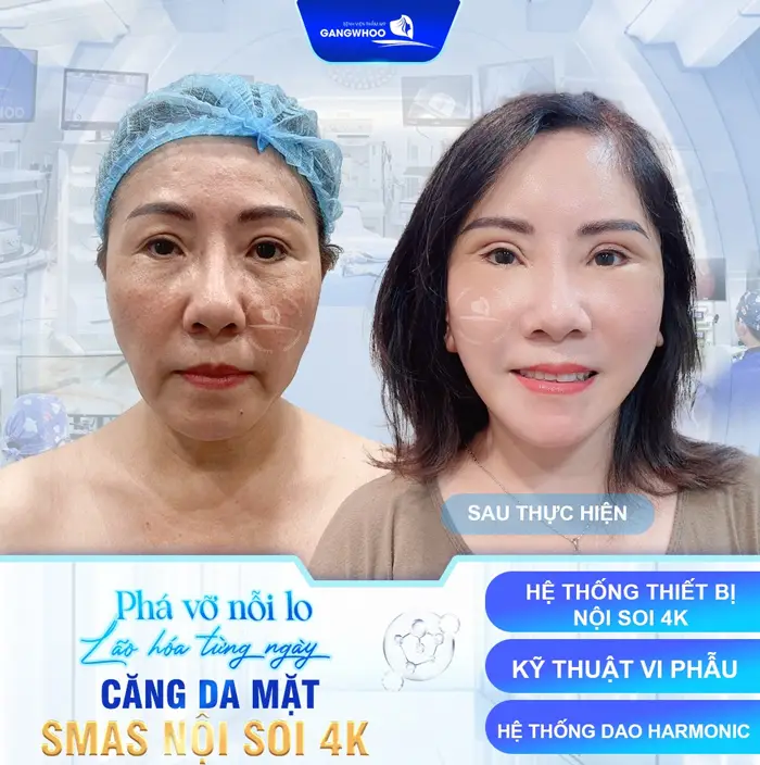 Danh Sách Cơ Sở Căng Da Mặt Ở Bình Phước Đẹp & An Toàn