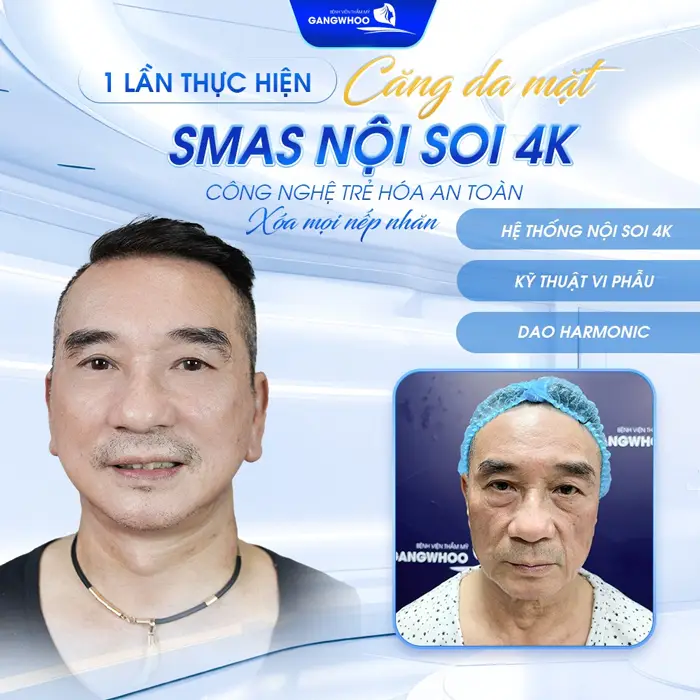 Tìm Hiểu Ngay 10 Địa Chỉ Căng Da Mặt Ở TPHCM Giúp Bạn Trẻ Hơn Tuổi Thật