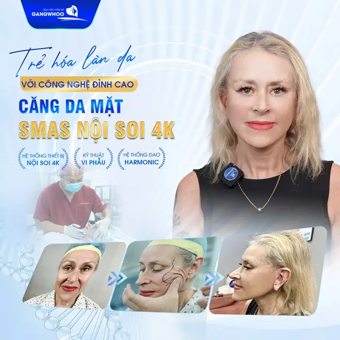 5 Địa Chỉ Căng Da Mặt Ở Bắc Ninh Uy Tín Cho Làn Da Trẻ Hóa