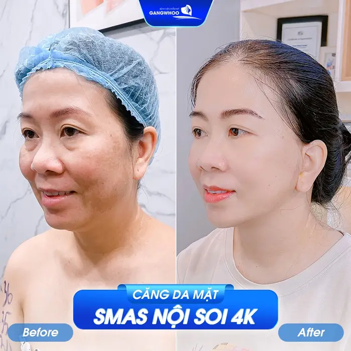 Bật Mí 7 Địa Chỉ Căng Da Mặt Ở Quảng Ngãi Giúp Trẻ Hóa Dài Lâu