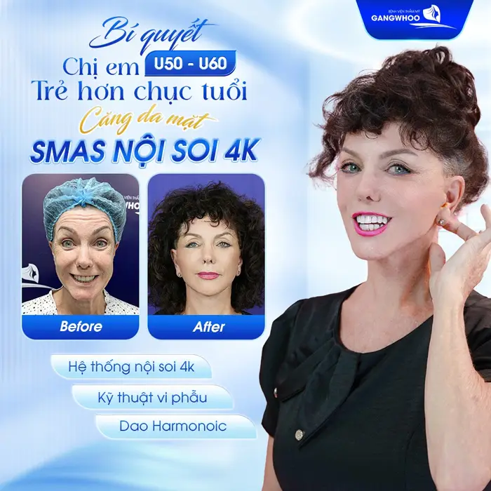 Muốn Căng Da Mặt Ở Ninh Thuận? Đây Là 6 Nơi Bạn Cần