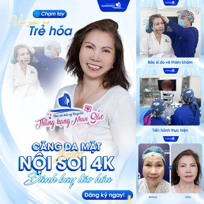 4 Nơi Căng Da Mặt Ở Hà Nam Được Nhiều Người Tin Chọn 