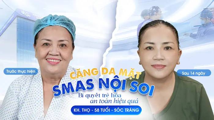 Khám Phá Những Địa Chỉ Căng Da Mặt Ở Hưng Yên Đáng Trải Nghiệm