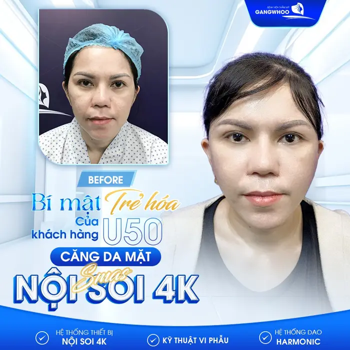 Hé Lộ 4 Nơi Căng Da Mặt Ở Nam Định Khách Hàng Khen Hết Lời