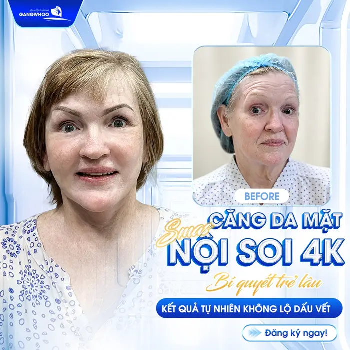 Trẻ Lại Đến Bất Ngờ Với 3 Địa Chỉ Căng Da Mặt Ở Lào Cai