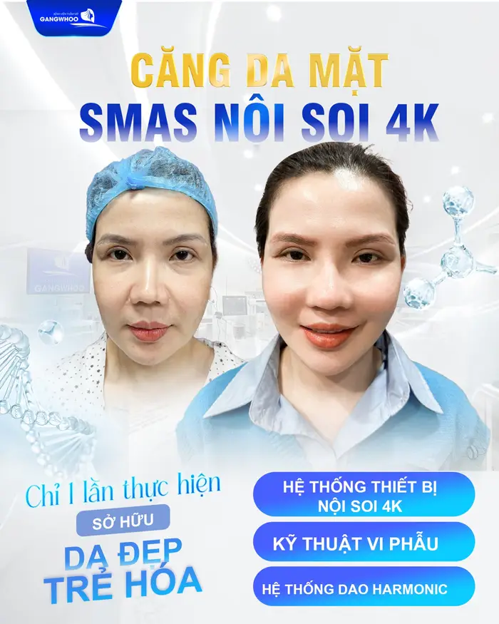 Say Bye Da Lão Hoá Với Top 5 Cơ Sở Căng Da Mặt Ở Bạc Liêu Này