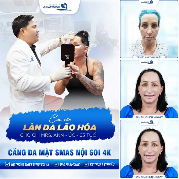 Bí Kíp “Hách Tuổi” Với 7 Cơ Sở Căng Da Mặt Ở Phú Yên Đừng Bỏ Qua