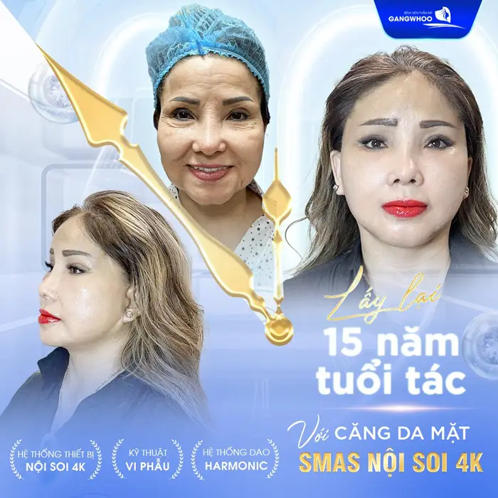 Bạn Cần Căng Da Mặt Ở Cà Mau? Đây Là Những Nơi Đáng Tin Cậy